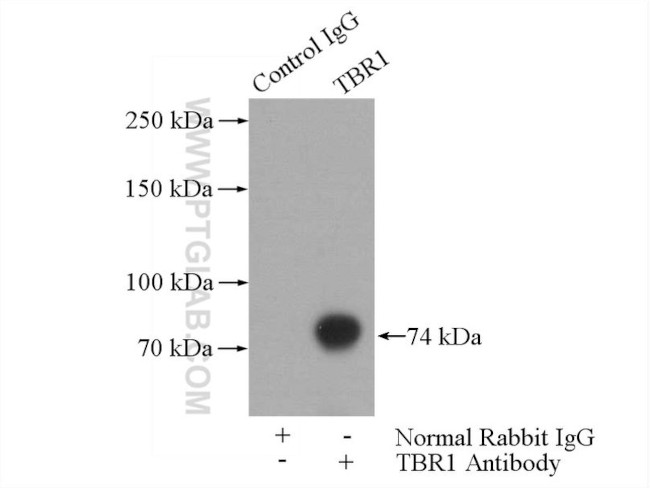 TBR1 Antibody in Immunoprecipitation (IP)