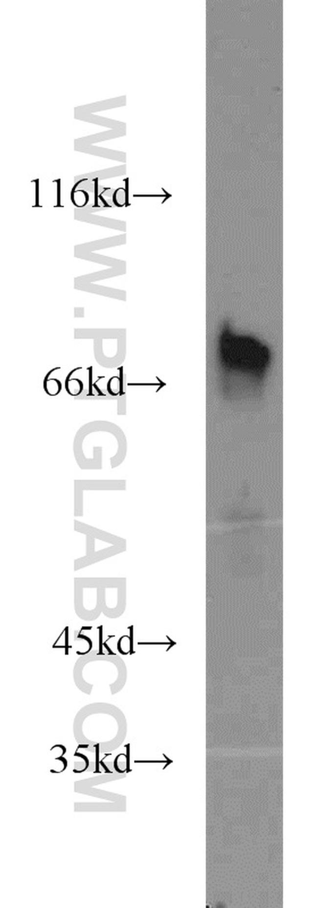 TBR1 Antibody in Western Blot (WB)