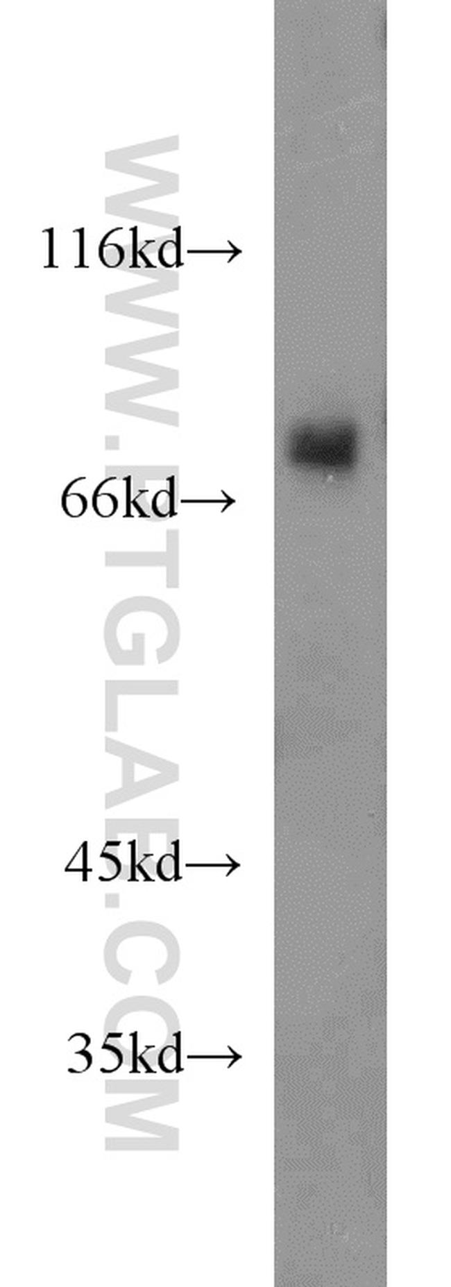 TBR1 Antibody in Western Blot (WB)