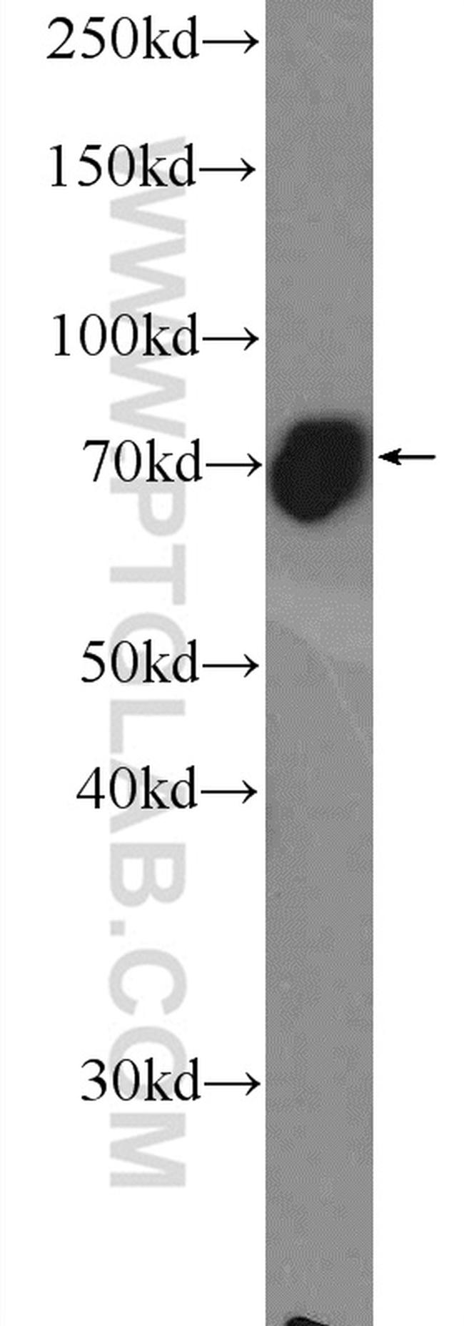 TBR1 Antibody in Western Blot (WB)