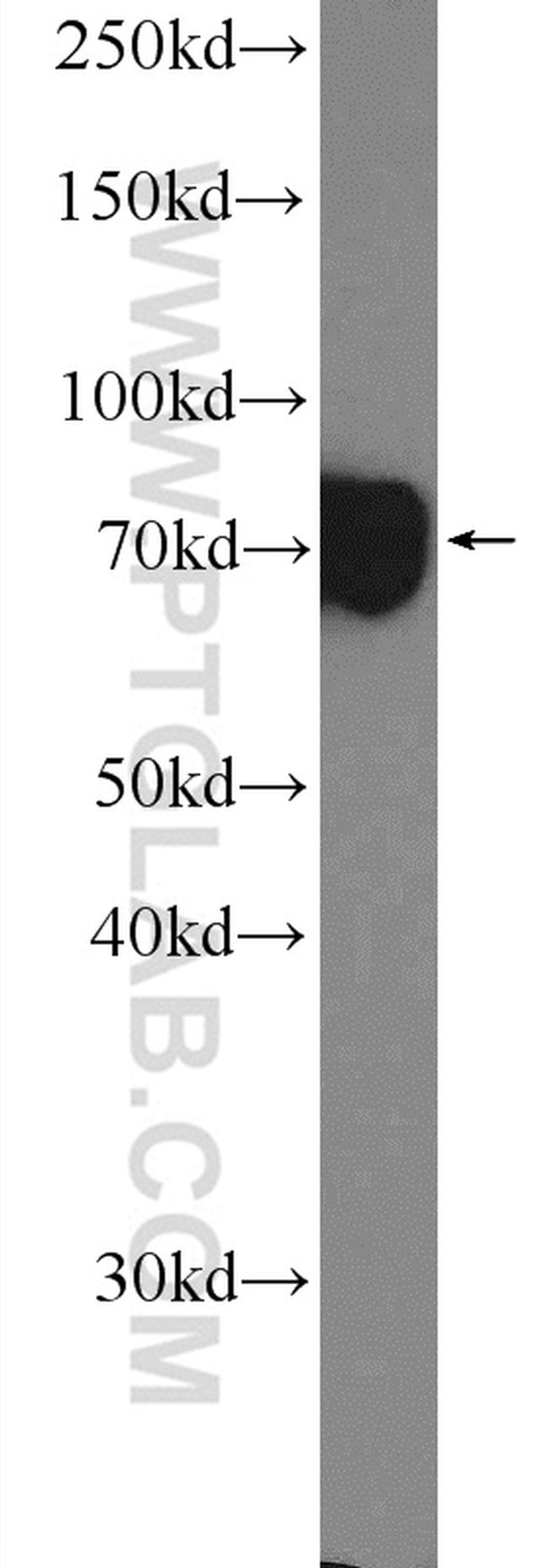 TBR1 Antibody in Western Blot (WB)