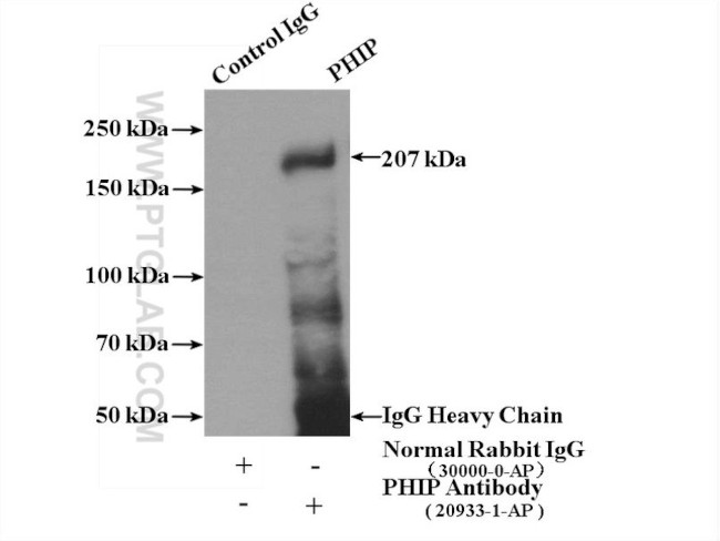 PHIP Antibody in Immunoprecipitation (IP)