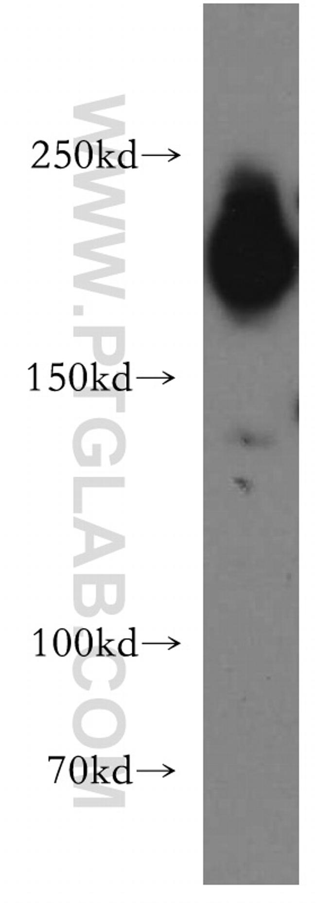 PHIP Antibody in Western Blot (WB)