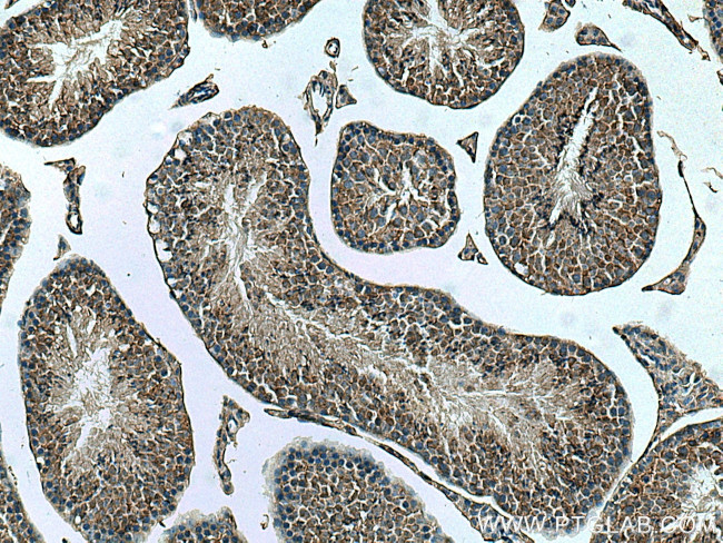 DPCD Antibody in Immunohistochemistry (Paraffin) (IHC (P))