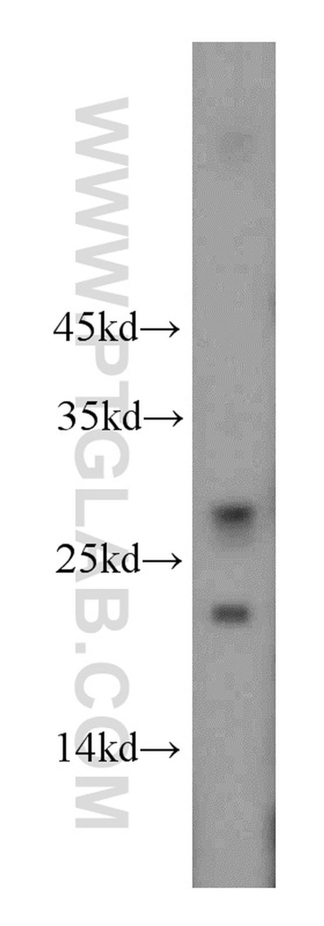 DPCD Antibody in Western Blot (WB)