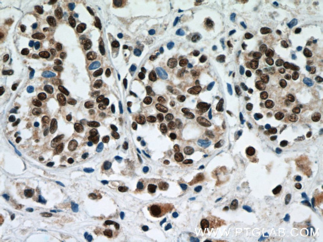 C1orf83 Antibody in Immunohistochemistry (Paraffin) (IHC (P))