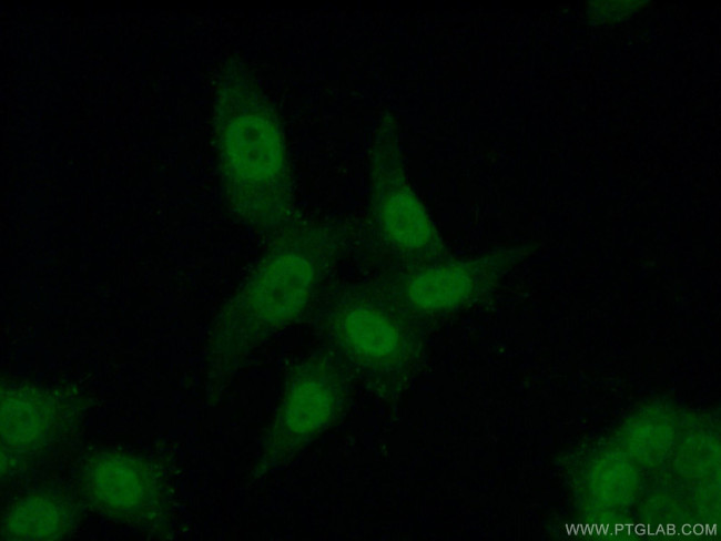 C1orf83 Antibody in Immunocytochemistry (ICC/IF)