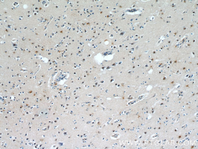 C1orf83 Antibody in Immunohistochemistry (Paraffin) (IHC (P))