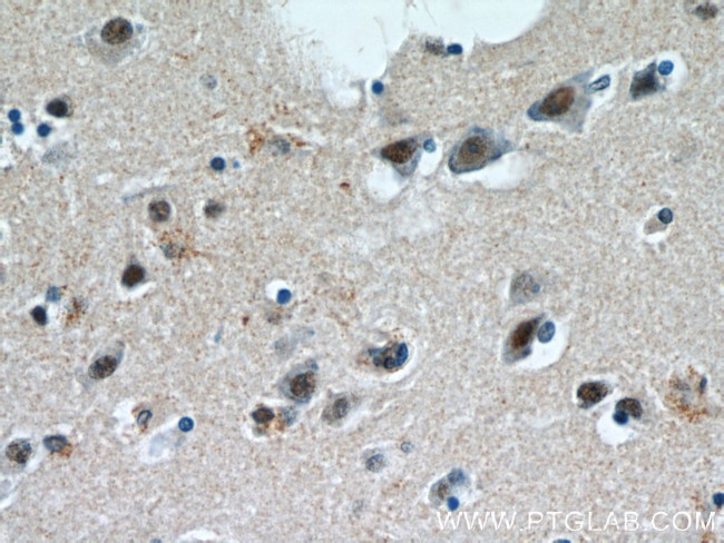 C1orf83 Antibody in Immunohistochemistry (Paraffin) (IHC (P))