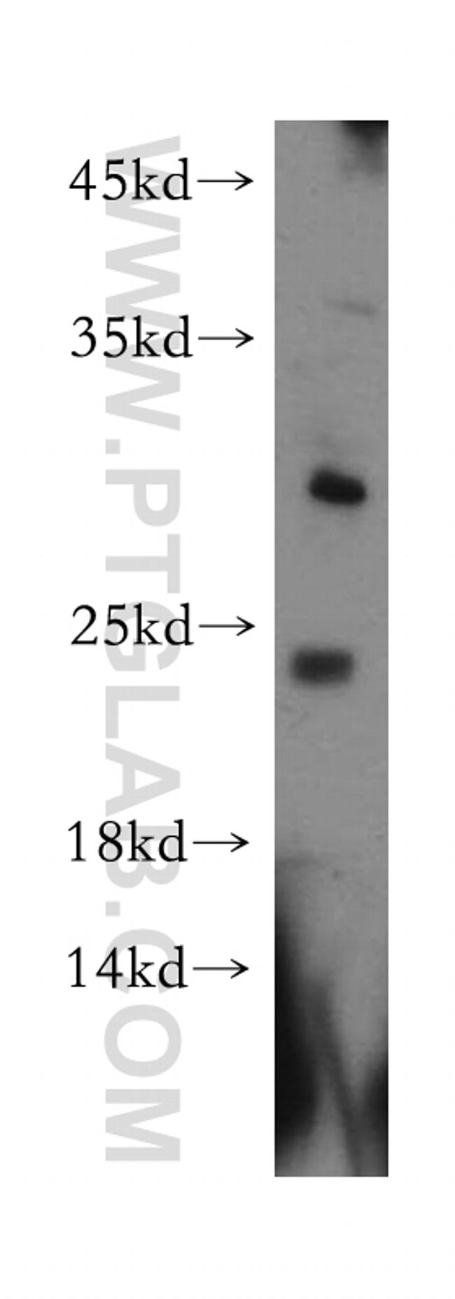 C1orf83 Antibody in Western Blot (WB)