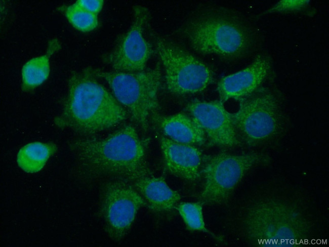 ACBD4 Antibody in Immunocytochemistry (ICC/IF)