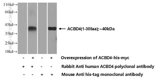 ACBD4 Antibody in Western Blot (WB)