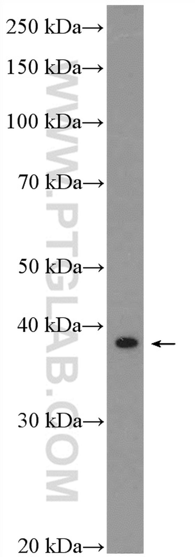 SAP30BP Antibody in Western Blot (WB)