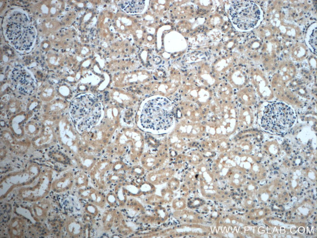 ZC3HAV1L Antibody in Immunohistochemistry (Paraffin) (IHC (P))