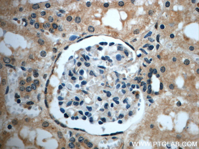 ZC3HAV1L Antibody in Immunohistochemistry (Paraffin) (IHC (P))