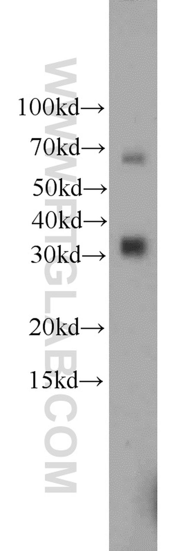 ZC3HAV1L Antibody in Western Blot (WB)