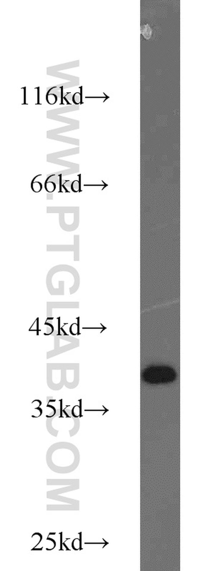 ZC3HAV1L Antibody in Western Blot (WB)