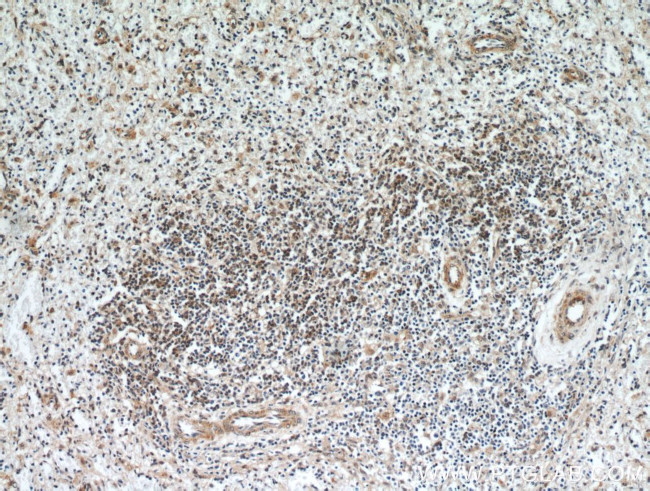 ABHD14B Antibody in Immunohistochemistry (Paraffin) (IHC (P))