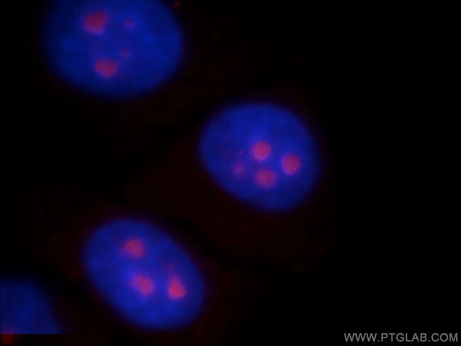 ABHD14B Antibody in Immunocytochemistry (ICC/IF)