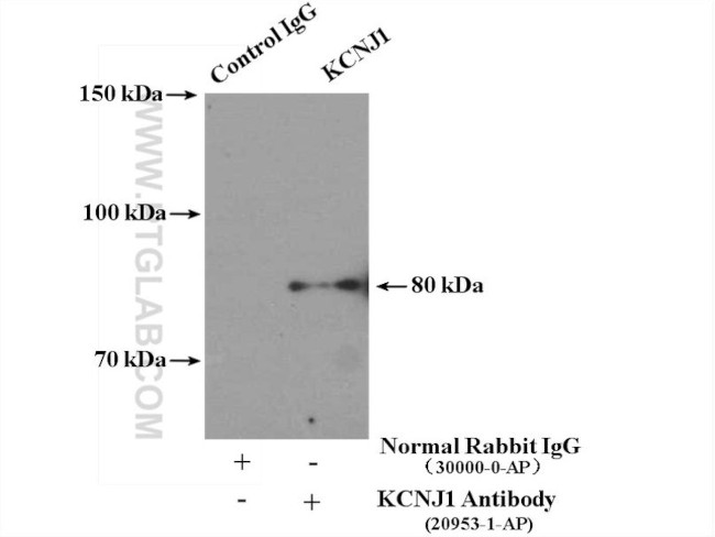 KCNJ1 Antibody in Immunoprecipitation (IP)