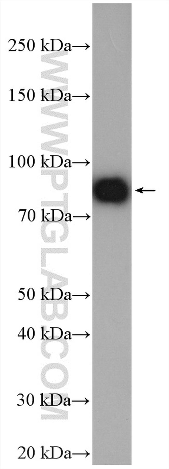 KCNJ1 Antibody in Western Blot (WB)