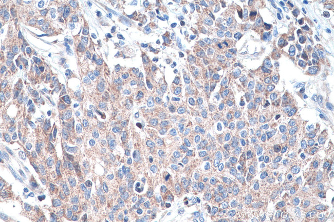 DNMT3A Antibody in Immunohistochemistry (Paraffin) (IHC (P))