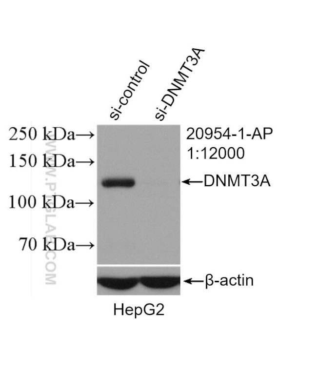 DNMT3A Antibody in Western Blot (WB)