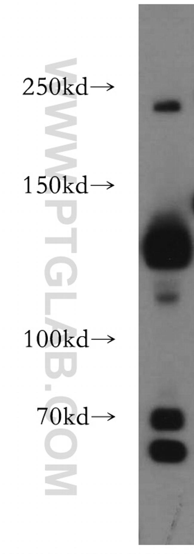 DNMT3A Antibody in Western Blot (WB)