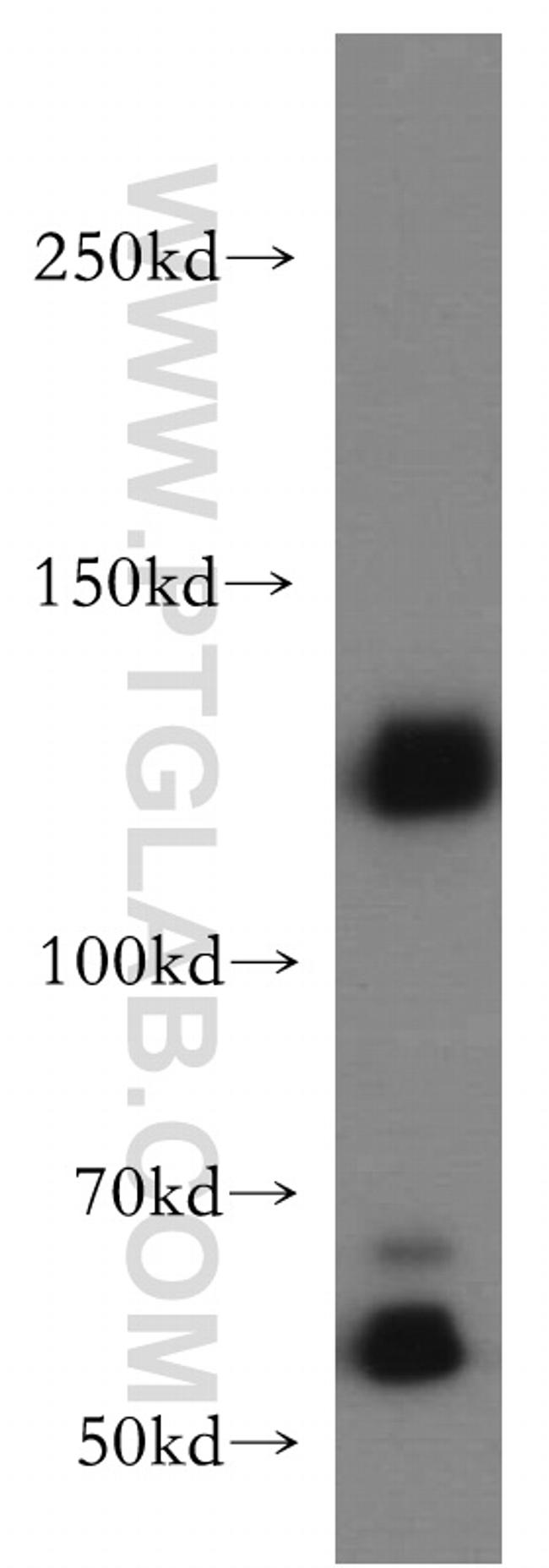 DNMT3A Antibody in Western Blot (WB)