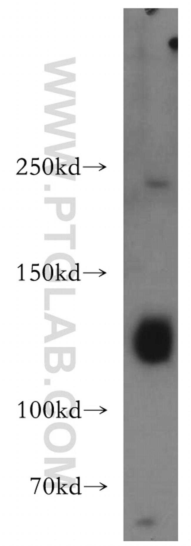 DNMT3A Antibody in Western Blot (WB)