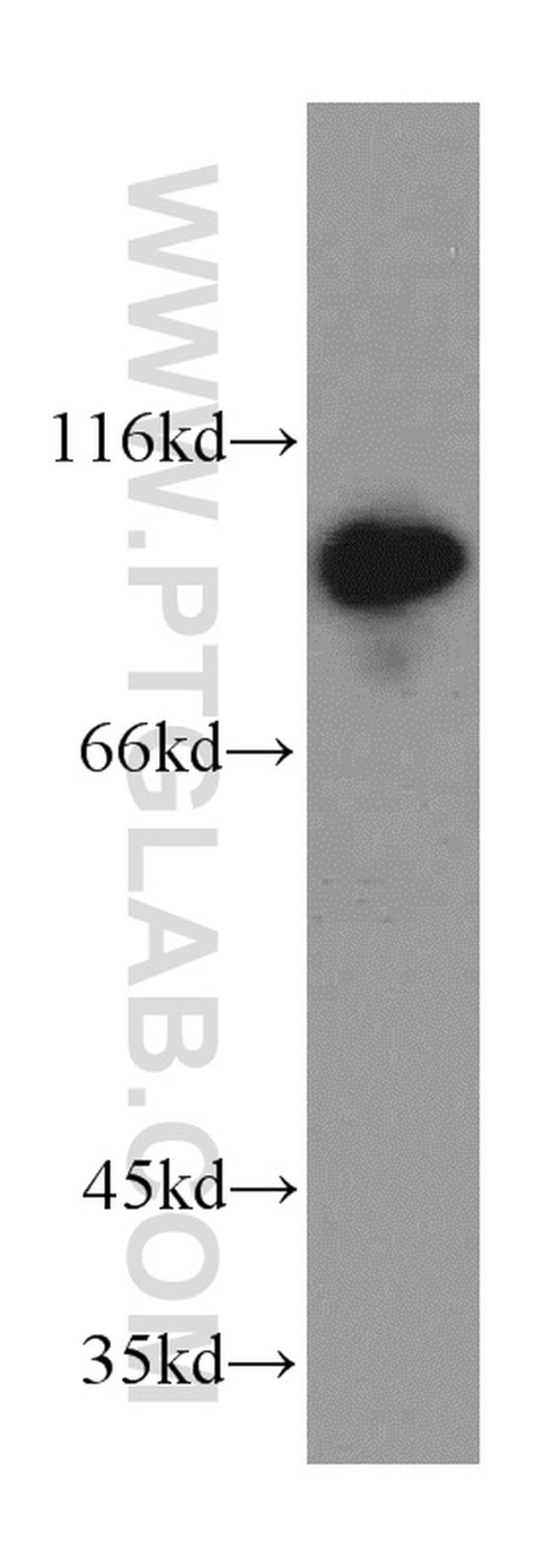 Advillin Antibody in Western Blot (WB)