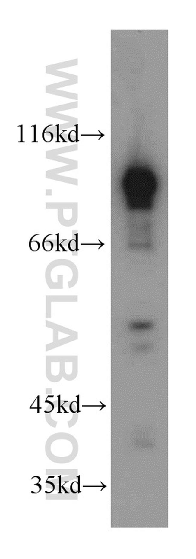 Advillin Antibody in Western Blot (WB)