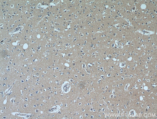 C1orf50 Antibody in Immunohistochemistry (Paraffin) (IHC (P))