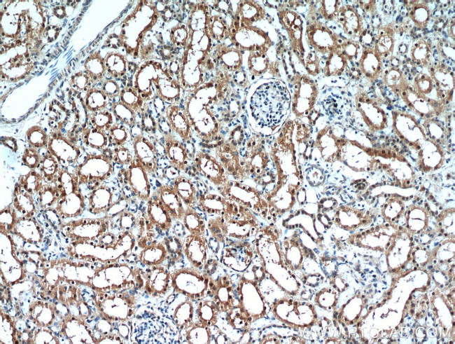 C1orf50 Antibody in Immunohistochemistry (Paraffin) (IHC (P))