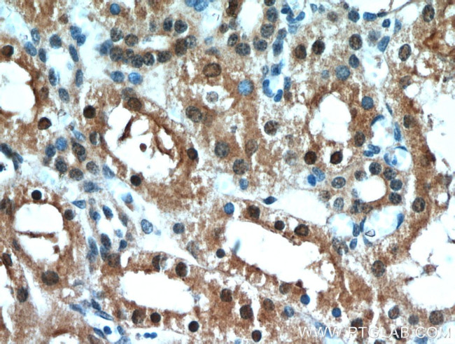 C1orf50 Antibody in Immunohistochemistry (Paraffin) (IHC (P))