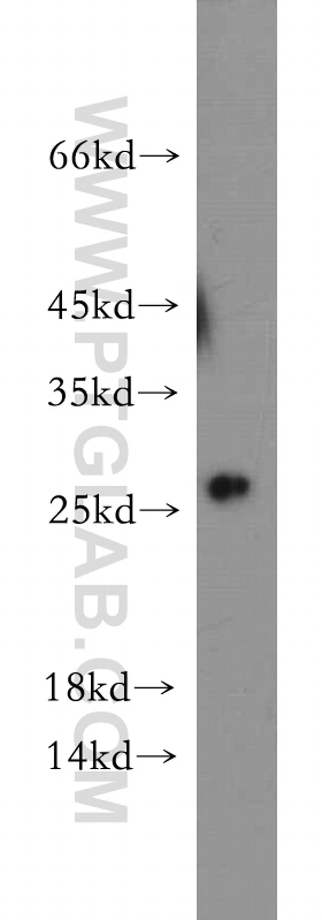 C1orf50 Antibody in Western Blot (WB)