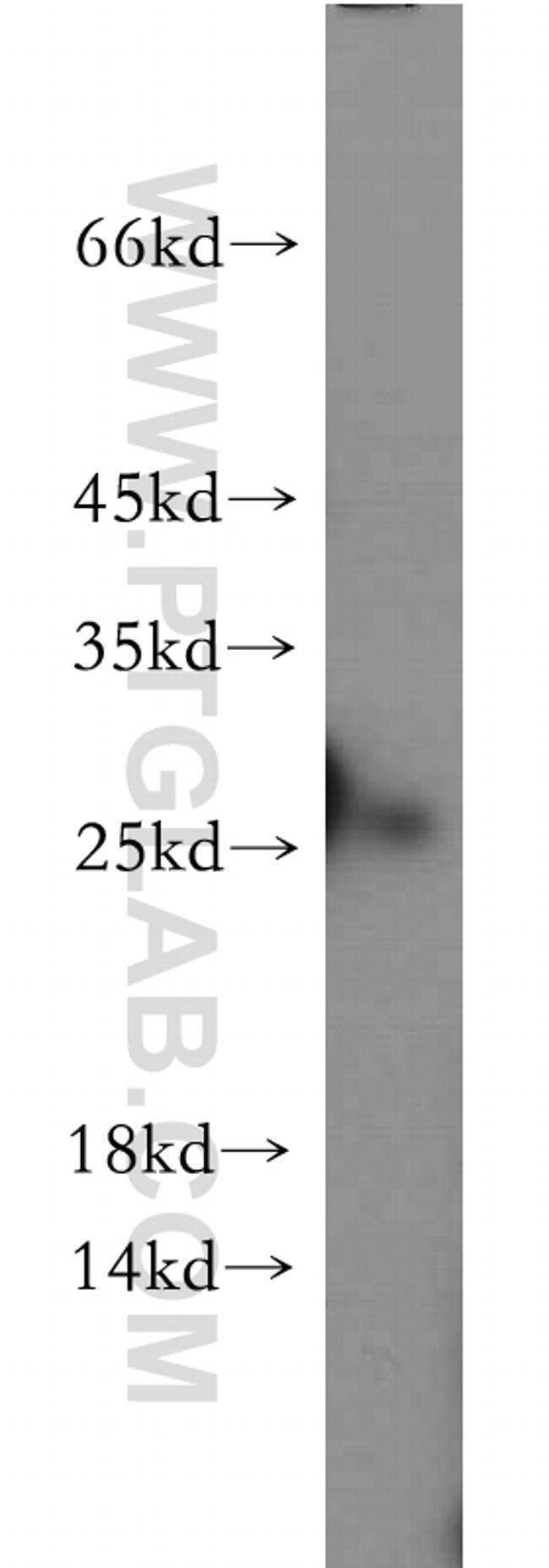 C1orf50 Antibody in Western Blot (WB)