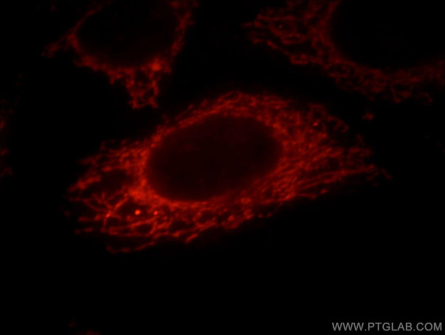 MRPP3 Antibody in Immunocytochemistry (ICC/IF)