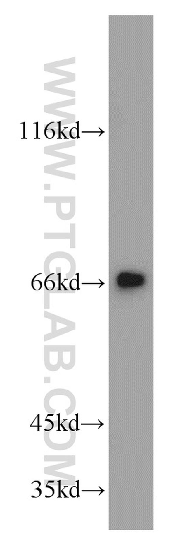 MRPP3 Antibody in Western Blot (WB)