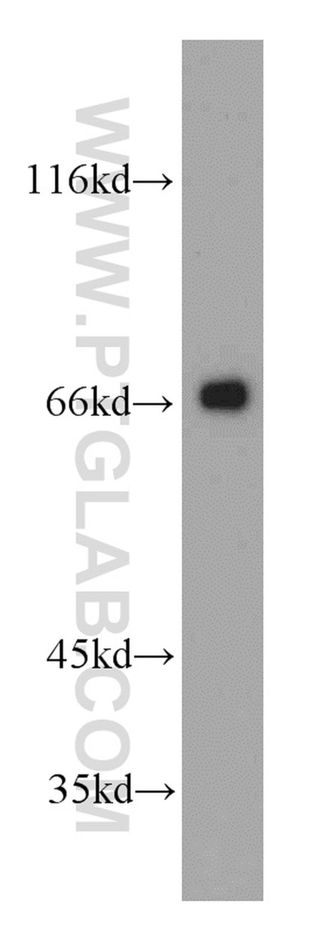 MRPP3 Antibody in Western Blot (WB)