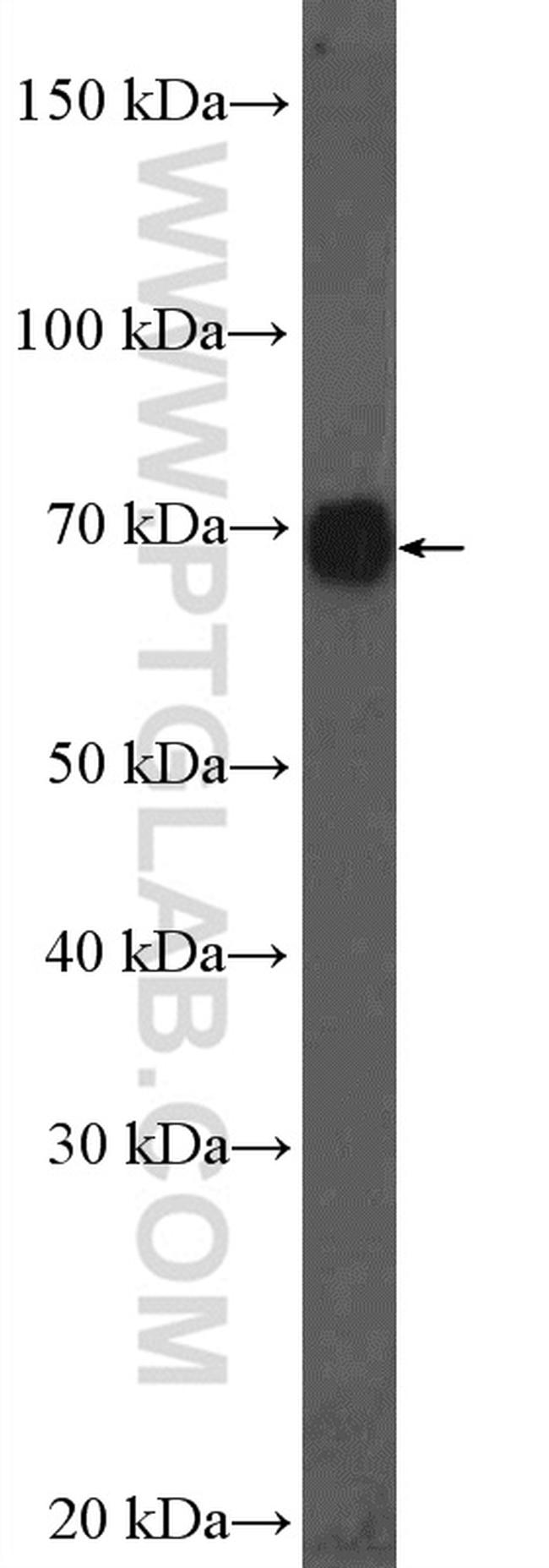 MRPP3 Antibody in Western Blot (WB)