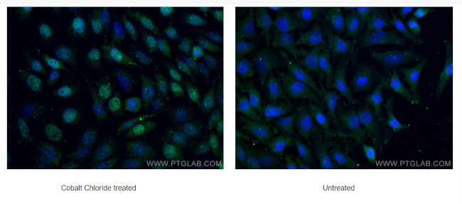 HIF1a Antibody in Immunocytochemistry (ICC/IF)