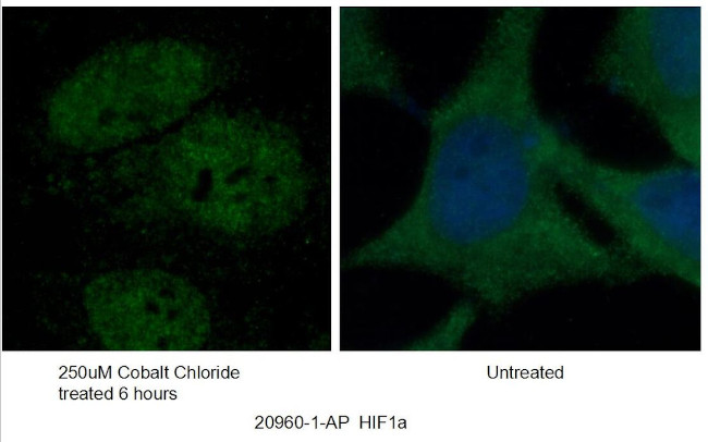 HIF1a Antibody in Immunocytochemistry (ICC/IF)