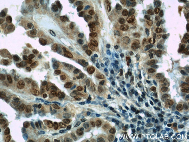 HIF1a Antibody in Immunohistochemistry (Paraffin) (IHC (P))