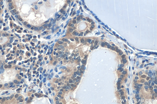 HIF1a Antibody in Immunohistochemistry (Paraffin) (IHC (P))