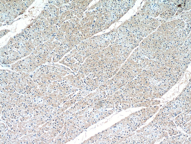 HIF1a Antibody in Immunohistochemistry (Paraffin) (IHC (P))