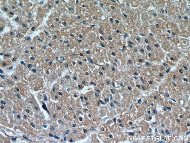 HIF1a Antibody in Immunohistochemistry (Paraffin) (IHC (P))