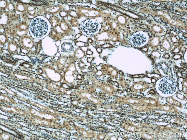 HIF1a Antibody in Immunohistochemistry (Paraffin) (IHC (P))