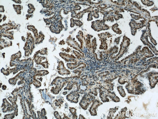 HIF1a Antibody in Immunohistochemistry (Paraffin) (IHC (P))