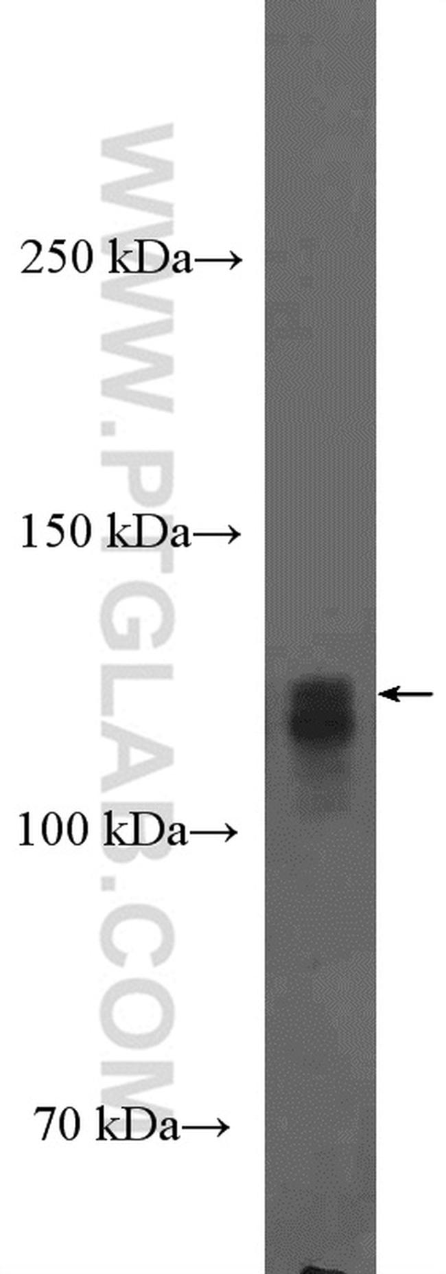 HIF1a Antibody in Western Blot (WB)